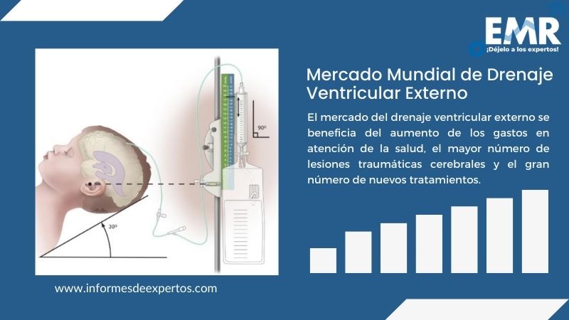 Informe del Mercado de Drenaje Ventricular Externo