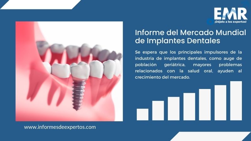 Informe del Mercado de Implantes Dentales