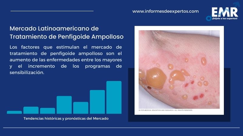 Informe del Mercado Latinoamericano de Tratamiento de Penfigoide Ampolloso