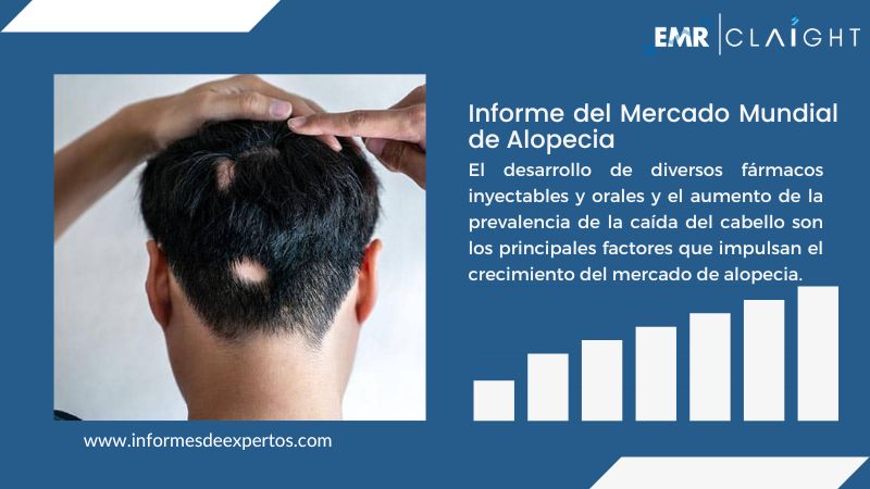 Informe del Mercado de Alopecia