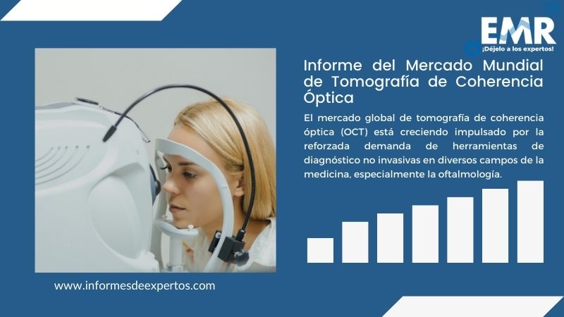 Informe del Mercado de Tomografía de Coherencia Óptica